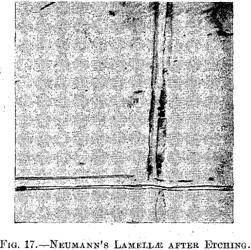 neumanns-lamallae-after-etching